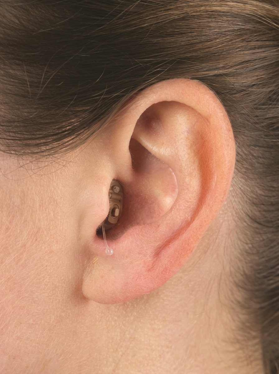 CIC(Completely-In-Canal) 보청기란? 특징과 장단점